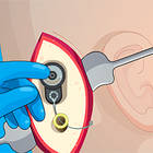 ear surgery