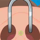 nose surgery