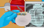 pacemaker surgery