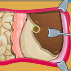 stomach surgery
